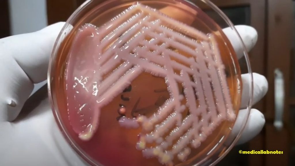 Acinetobacter and Klebsiella colony morphology on Macconkey agar