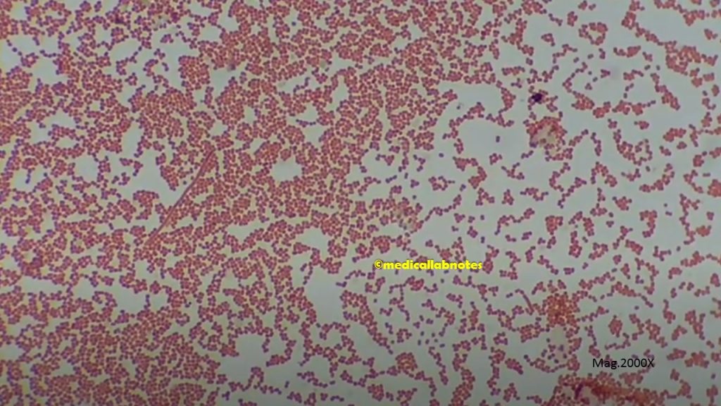 Acinetobacter in Gram stained smear of culture showing  Gram negative coccobacilli, small to large rods too