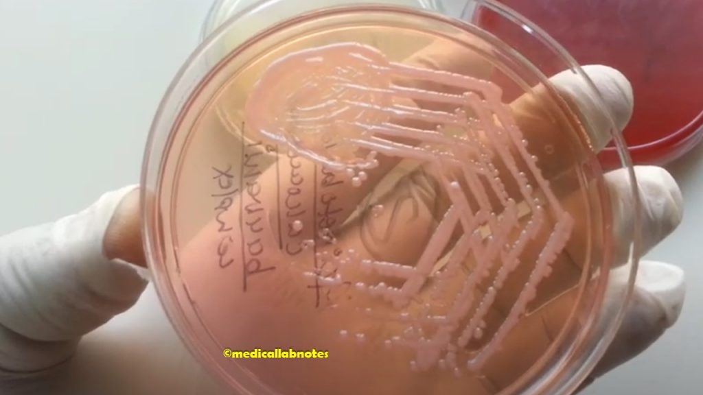 Acinetobacter species colony morphology on MacConkey agar