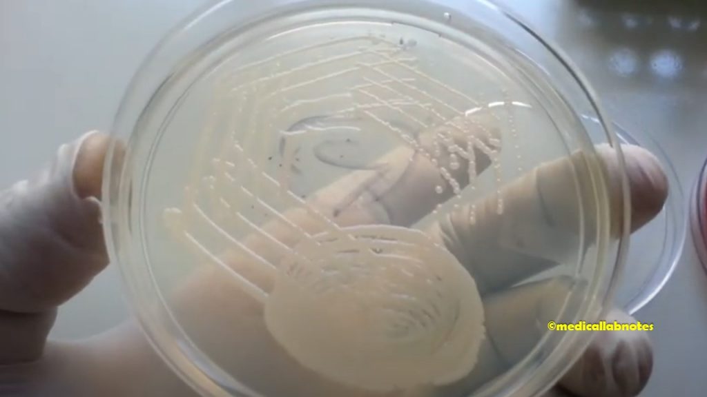 Acinetobacter species colony morphology on Nutrient agar