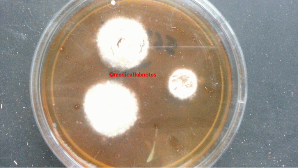 Acremonium powdery colonies on SDA 