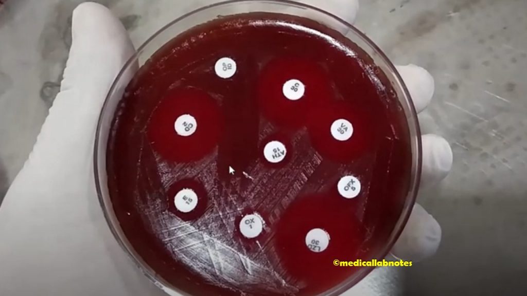 Antimicrobial Susceptibility Testing (AST) Pattern of Beta-Hemolytic streptococci