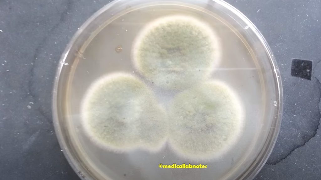 Aspergillus fumigatus colony morphology on Sabouraud Dextrose Agar (SDA)