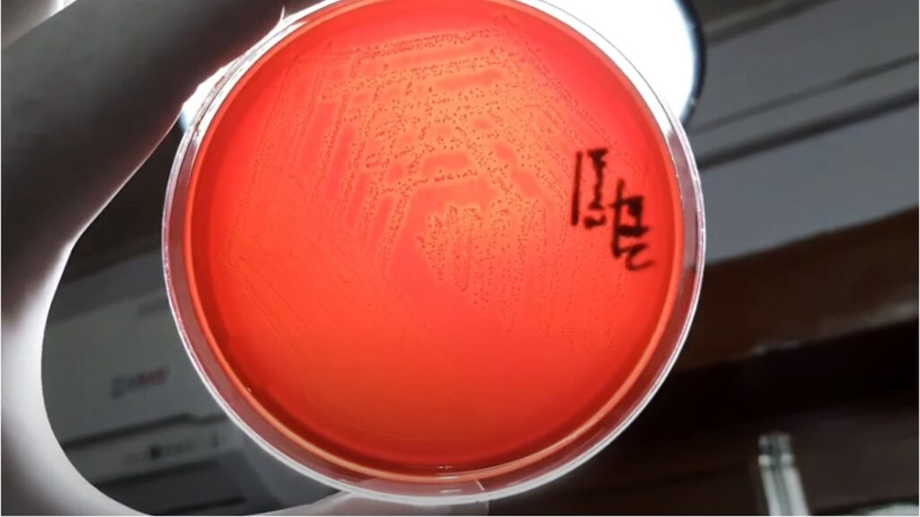 Beta-hemolytic colony of streptococci on blood agar