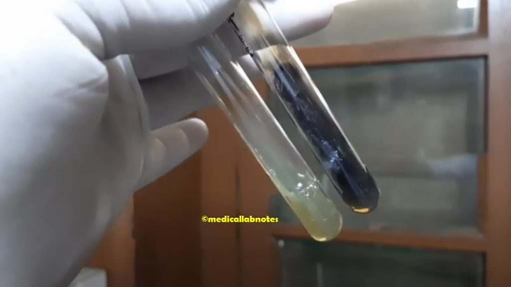 Bile Esculin Test  Positive Enterococcus species Demonstration