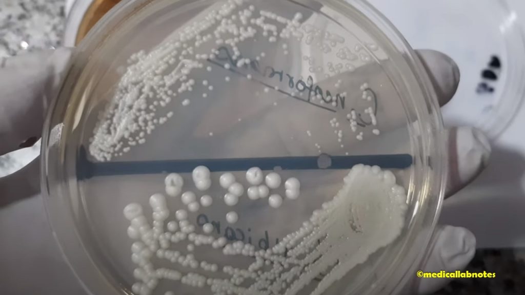 Candida albicans and Cryptococcus neoformans growth on SDA