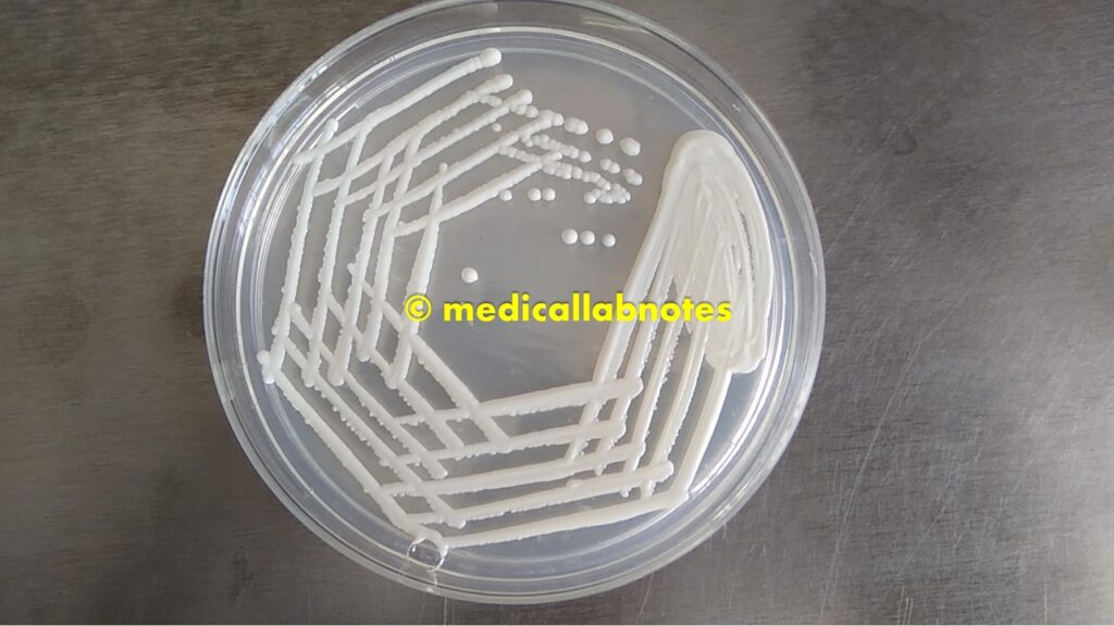 Candida albicans growth on SDA