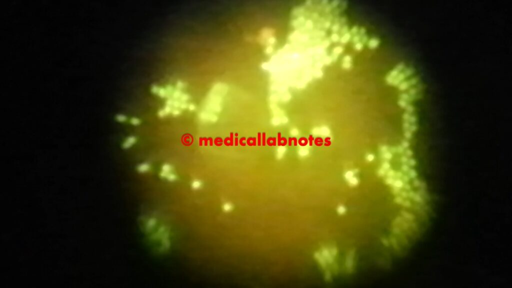 Candida albicans under Fluorescence microscope stained with Acridine Orange