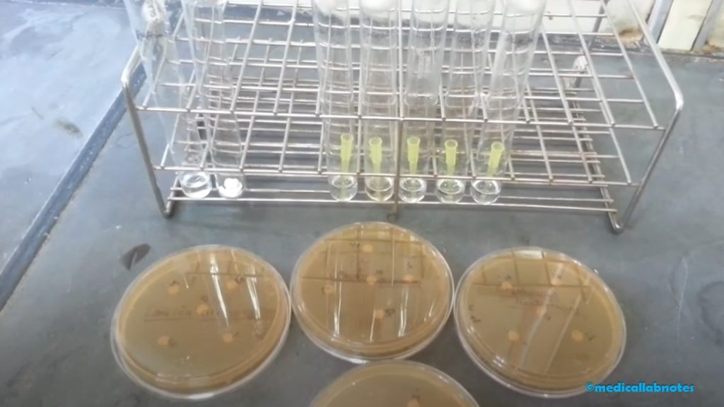 Carbohydrate Assimilation Test of Various Yeasts