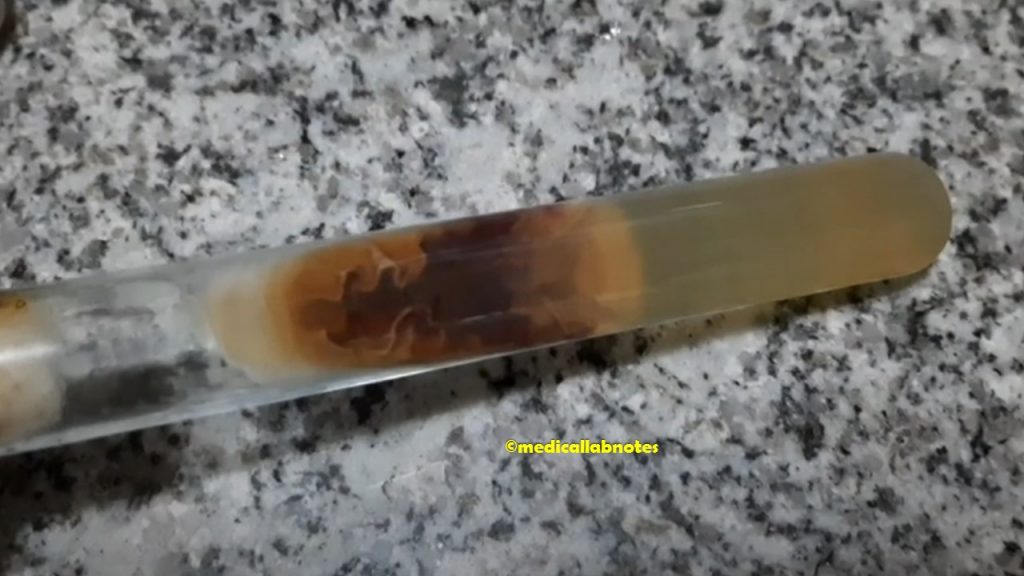 Cladosporium reverse pigment on SDA