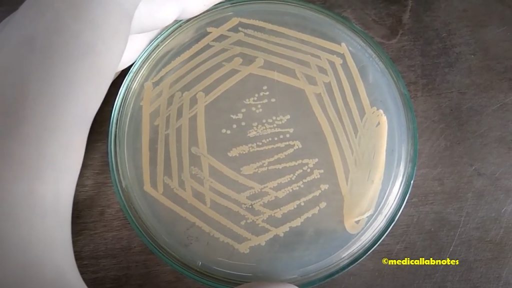 Colony characteristics of Staphylococcus aureus on nutrient agar