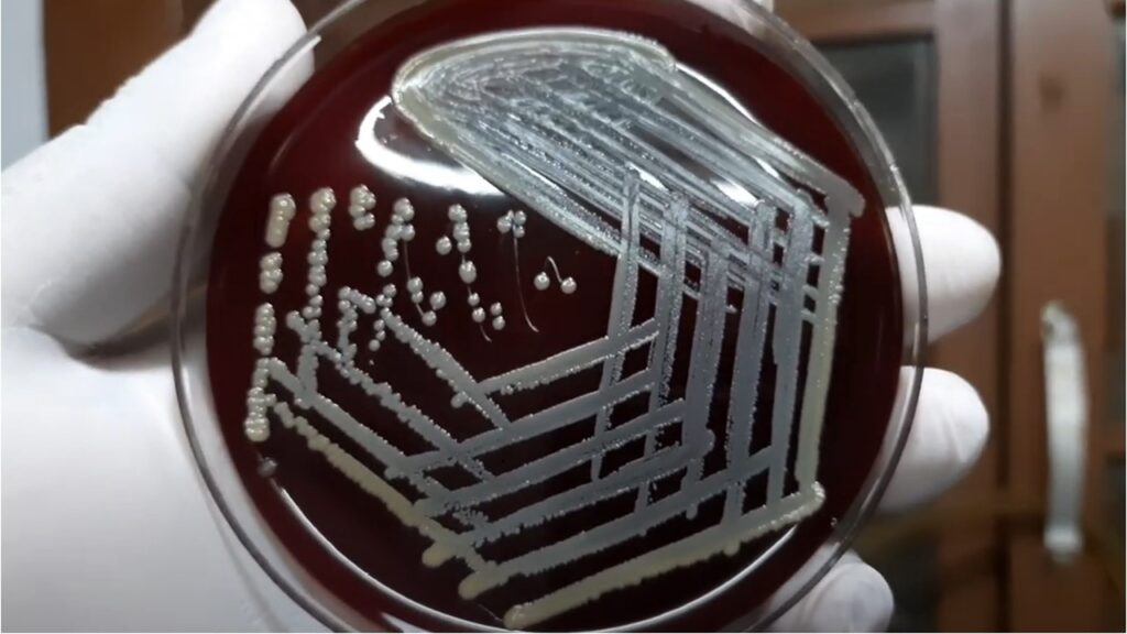 Colony morphology of Staphylococcus aureus on blood agar