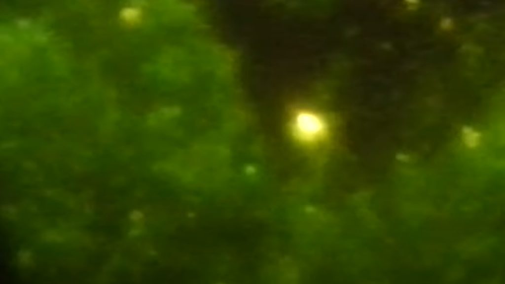 Cryptosporidium parvum oocyst in Auramine phenol stain stained smear fluorescence microscopy