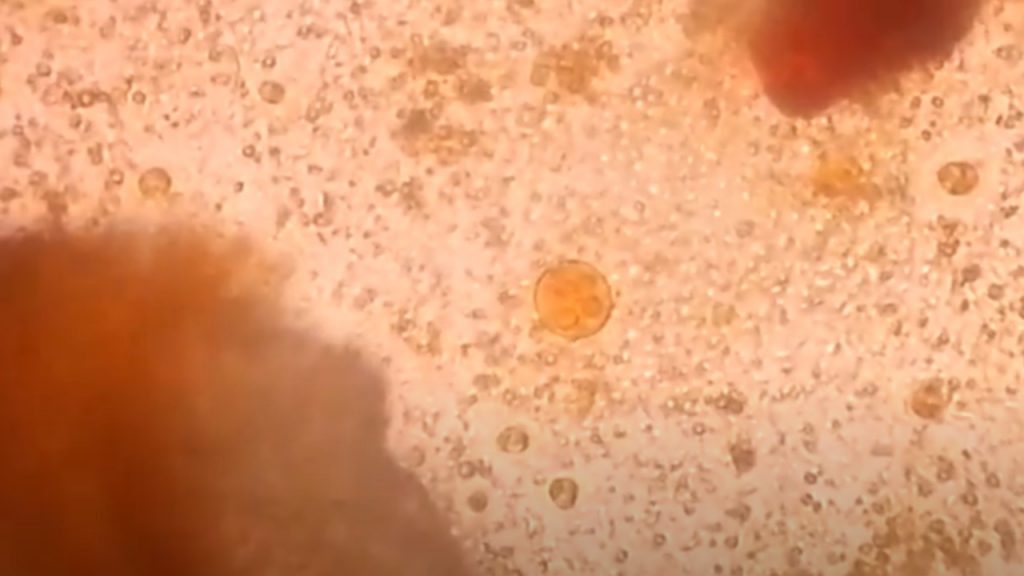 Cyst of Entamoeba histolytica or dispar in an iodine wet mount microscopy