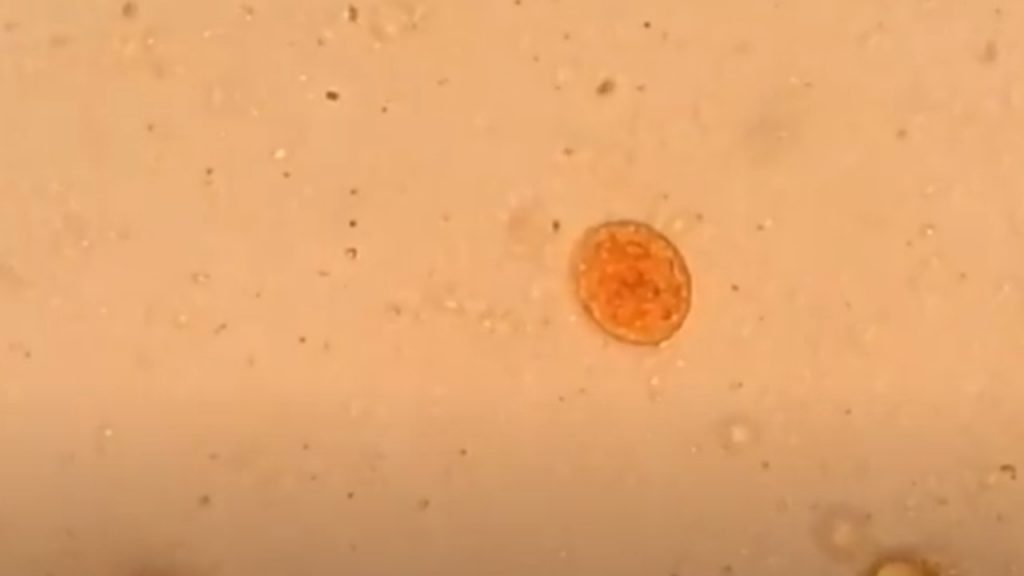 Entamoeba coli cyst with 8 nuclei in iodine wet mount