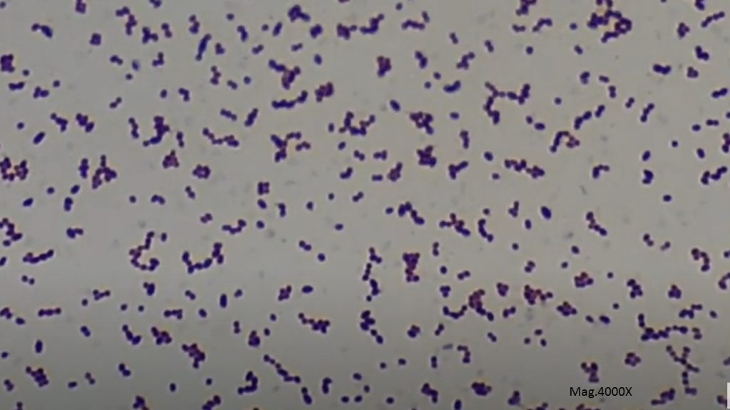 Enterococcus in Gram stained smear of culture showing Gram positive cocci in singles, pairs and short chains
