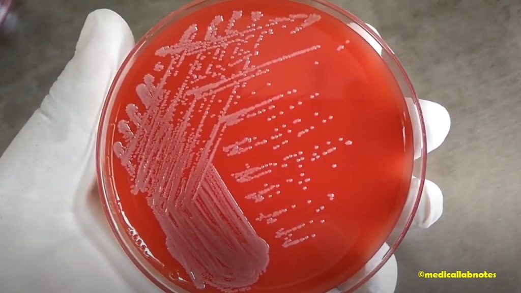 Escherichia coli colony morphology on  blood agar 