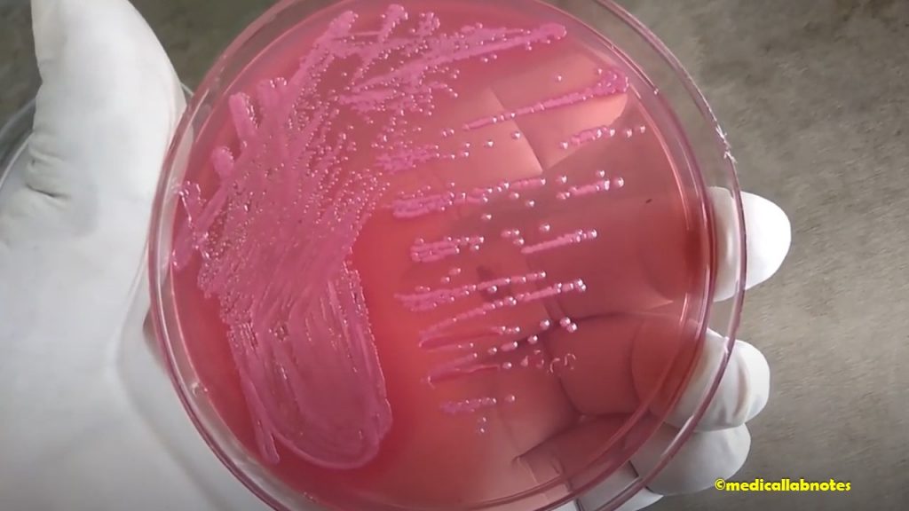 Escherichia coli colony morphology on MacConkey medium showing lactose fermenting colonies