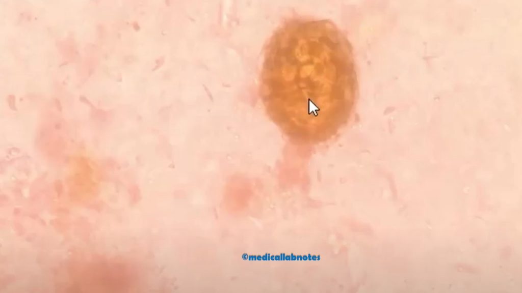 Fertilized egg changing to larva of Ascaris or round worm in stored stool microscopy