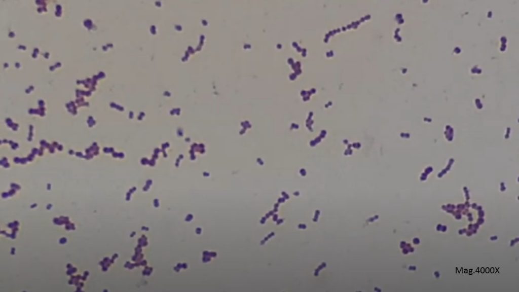 Gram positive cocci in singles, pairs and chains of Streptococcus pyogenes