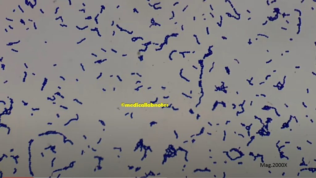 Gram positive cocci in singles, pairs, short chains and long chains of Viridans streptococci in Gram stained smear of culture