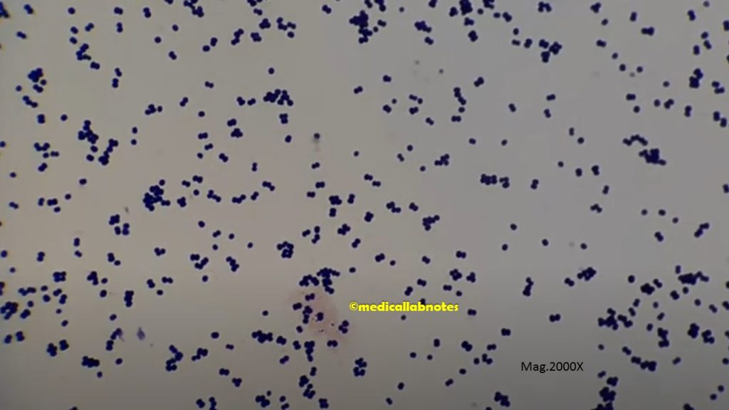 Gram-positive cocci in tetrads of Micrococcus species at a magnification of 2000X
