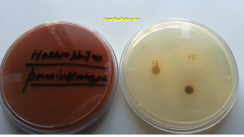 Haemophilus parainfluenzae growth on chocolate agar and nutrient agar having X, V and XV disks