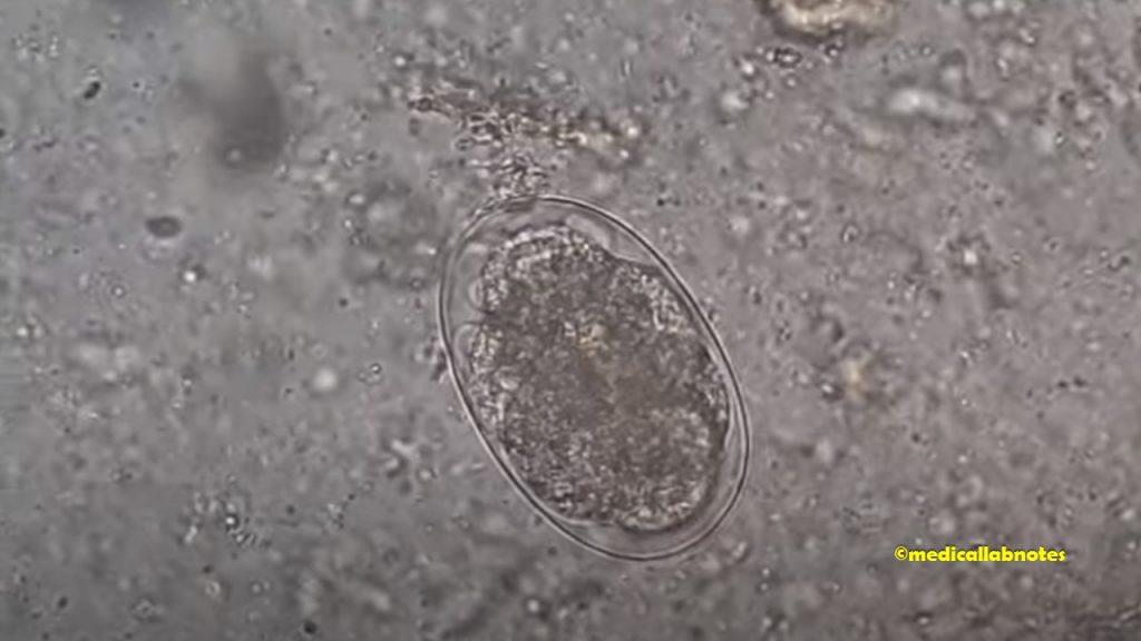 Hookworm egg in an unstained wet mount