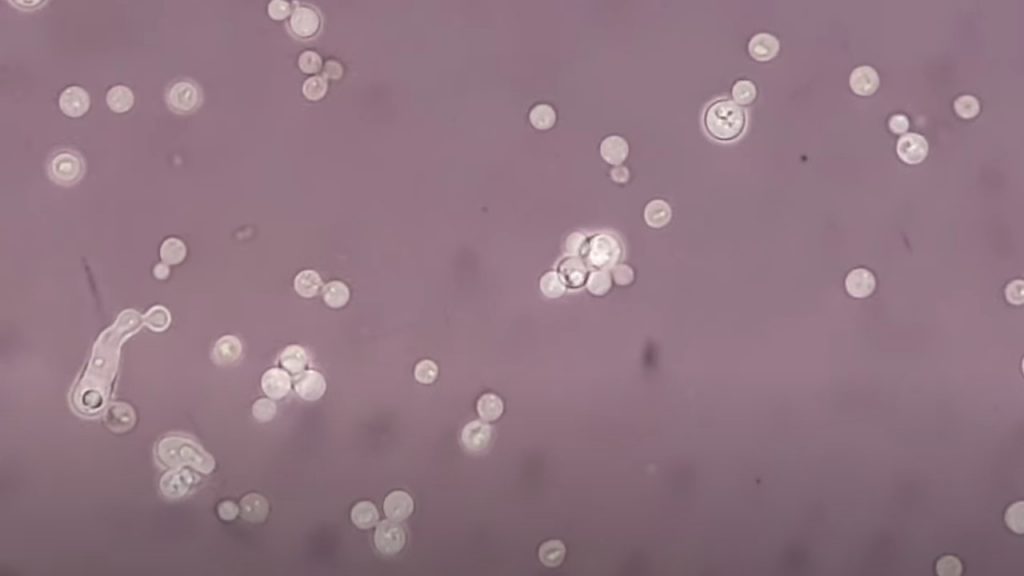 India Ink Preparation from culture of Cryptococcus neoformans