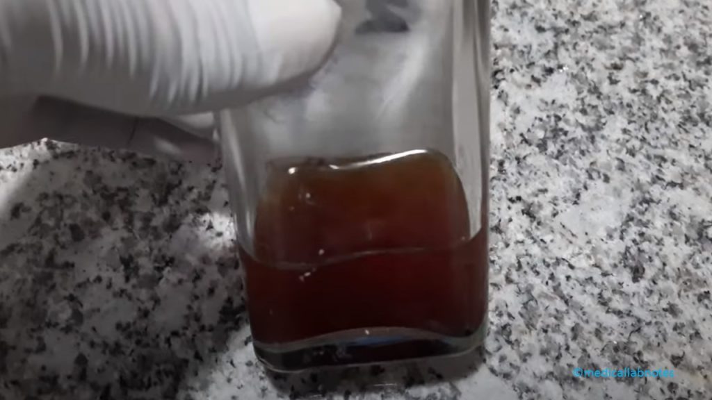 Klebsiella in BHI broth of a patient having pyrexia of unknown origin (PUO) requested  blood culture