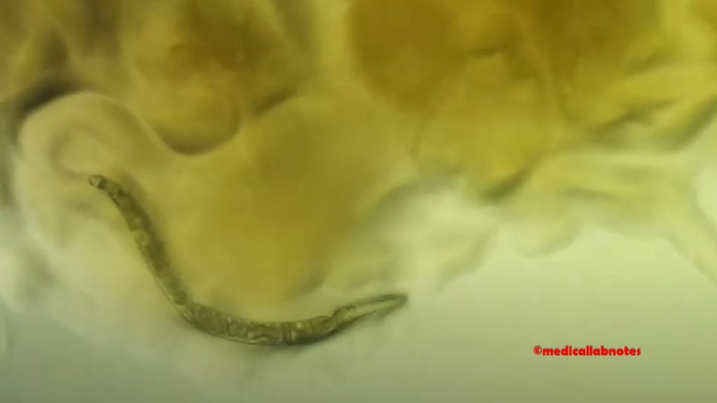 Larva of parasite, Strongyloides stercoralis in culured MHA plate Microscopy