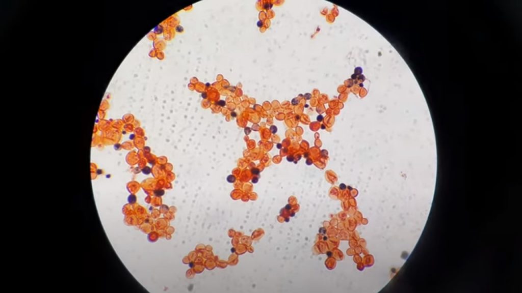 Live and dead Cryptococcus under the Microscope