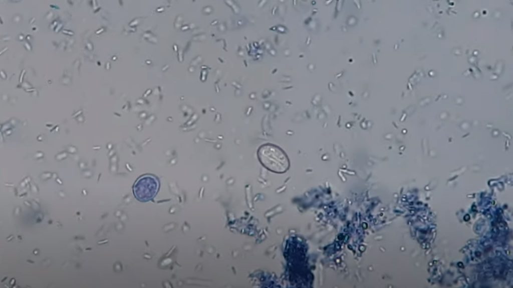 Methylene Blue wet mount of stool Microscopy showing cysts of Giardia lamblia