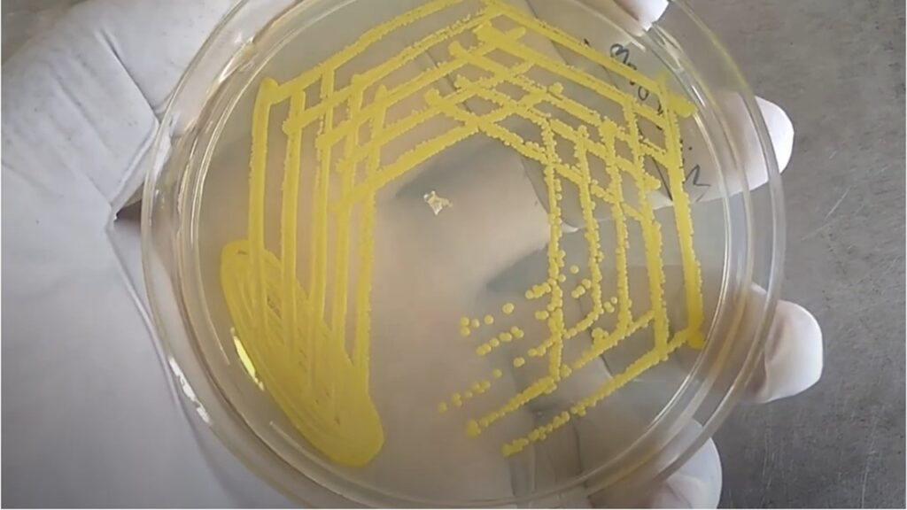 Micrococcus luteus yellow color colony on nutrient agar