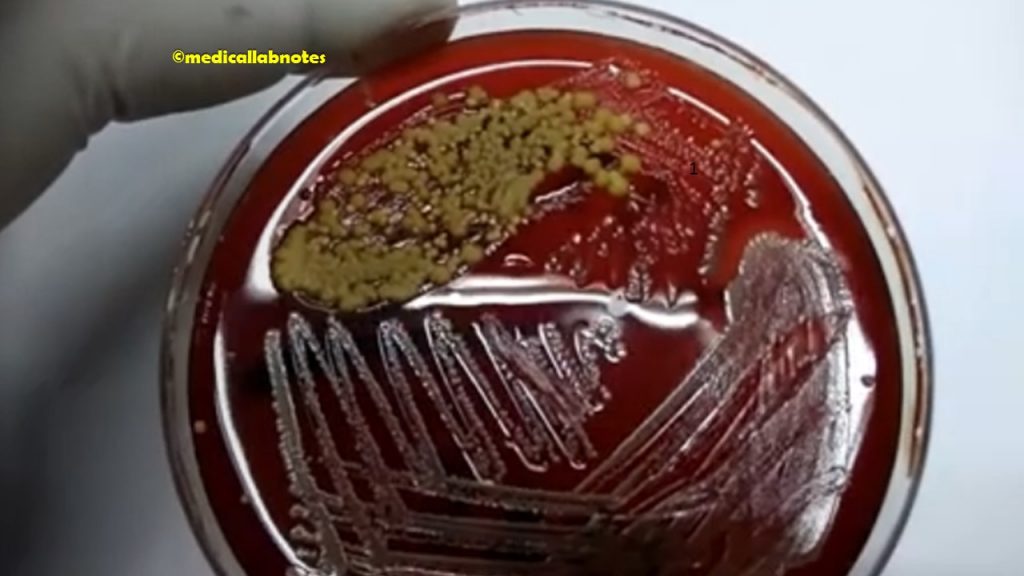 Neisseria meningitidis colony morphology on blood agar