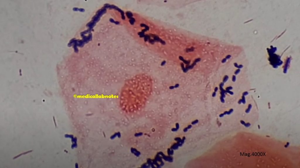Non-Ideal Gram-stained smear of sputum at a magnification of 4000X
