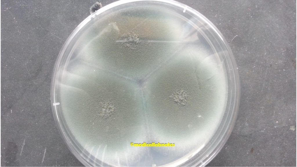 Penicillium colony morphology on Potato dextrose agar (PDA)