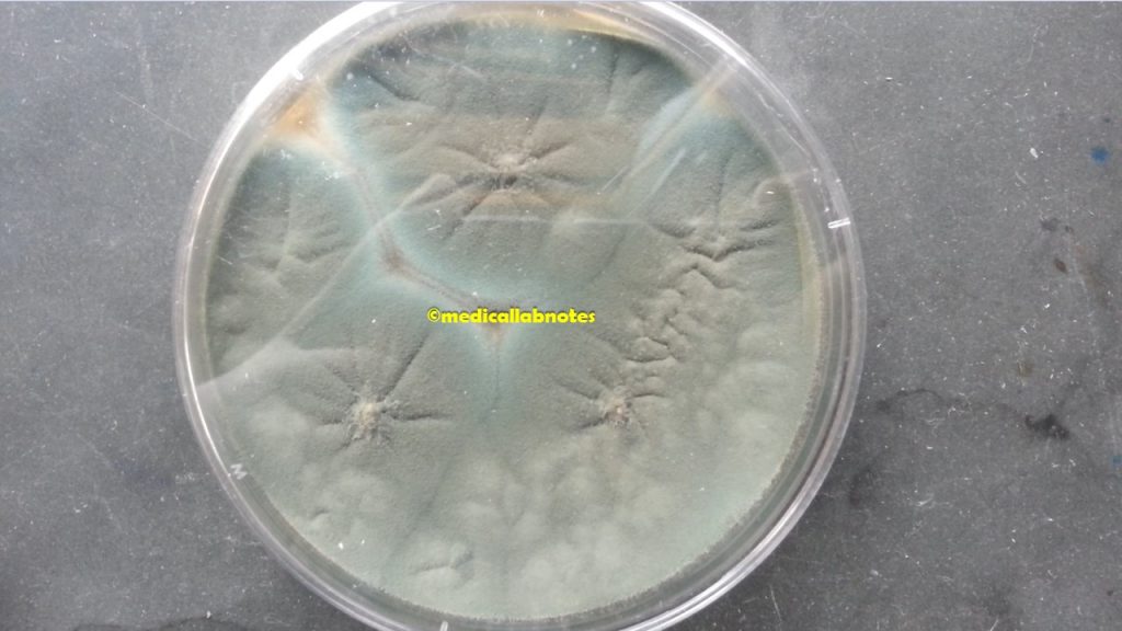 Penicillium colony morphology on SDA