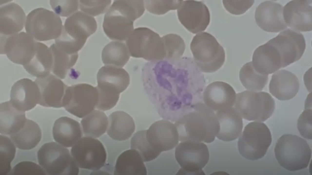 Atlas of Blood Cells in Hematology: Introduction, List of Content