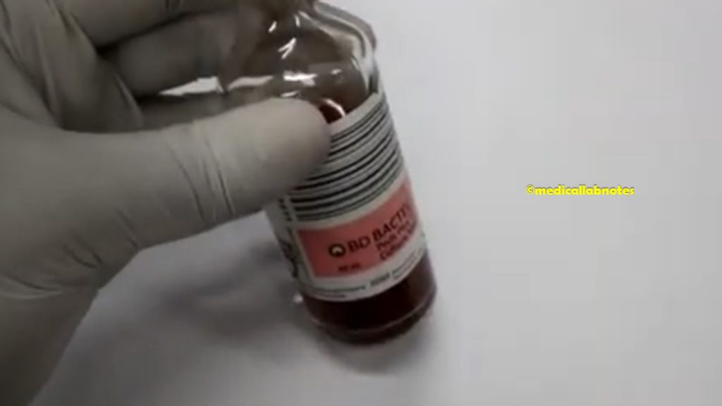 Positive blood culture bottle of a patient having septicemia