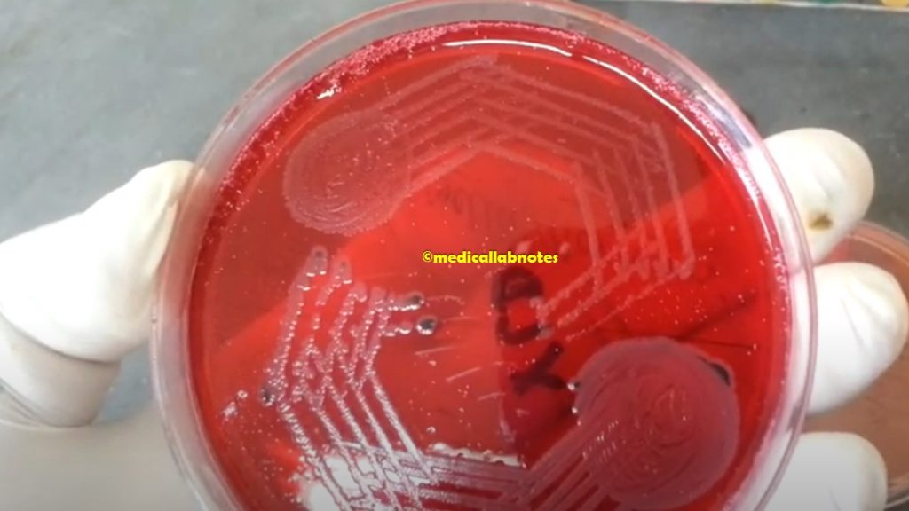 Salmonella Typhi and Shigella sonnei in XLD agar