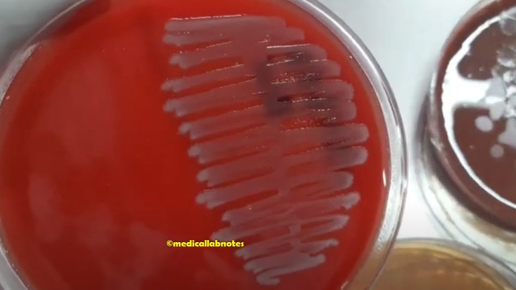 Salmonella growth on blood agar after subculturing from a liquid medium, BD BACTEC Bottle