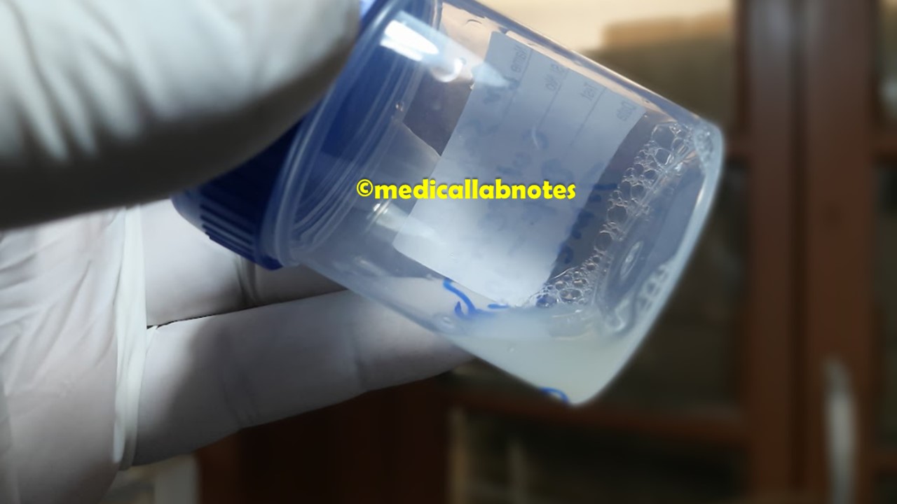 Semen Analysis Introduction List Of Tests Unit And Normal Range