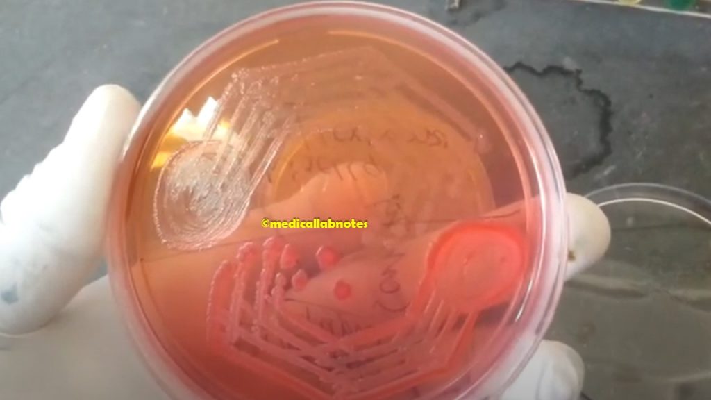 Shigella and Escherichia coli on Sorbitol-MacConkey agar 