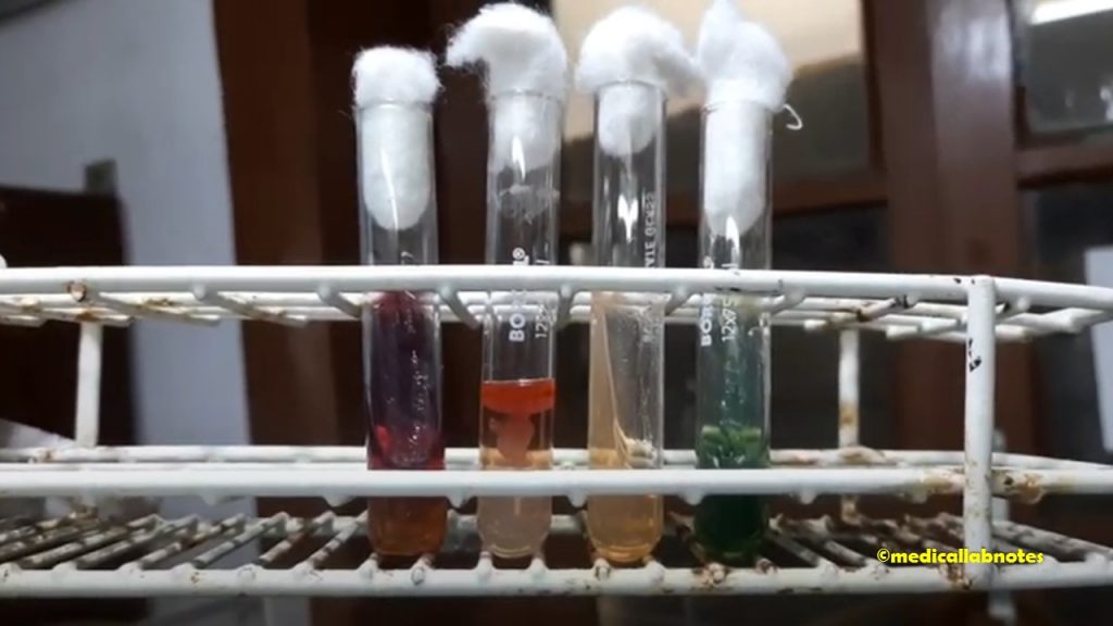 Shigella groups A,B and C Biochemical Tests Demonstration