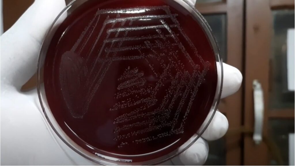 Small size colony of bacteria