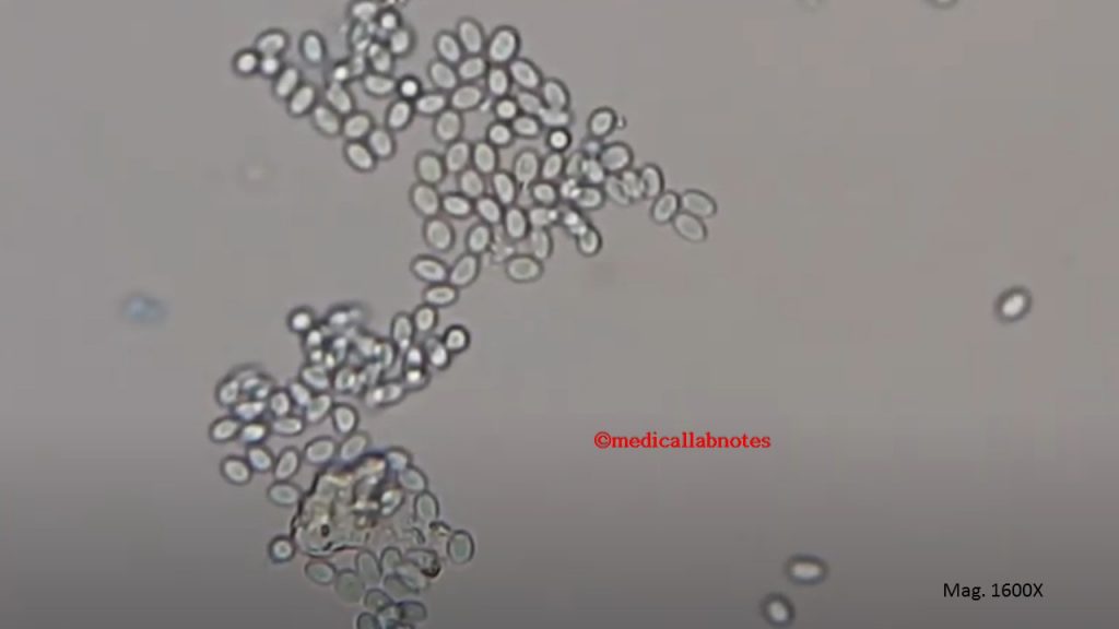 Sporangiospores or conidia of Mucor species in LPCB tease mount at magnification of 1600X