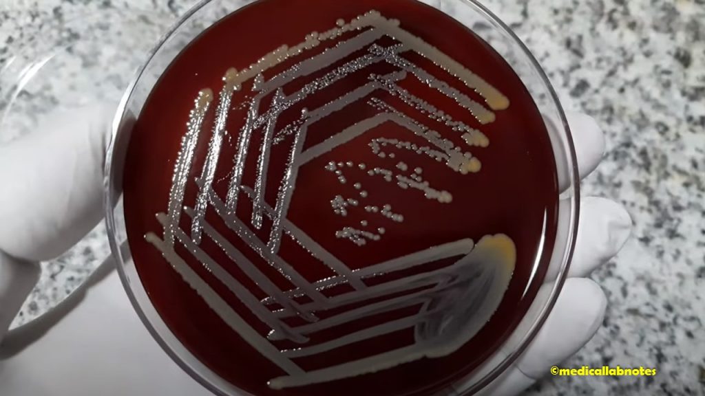 Staphylococcus aureus golden yellow colony morphology on blood agar