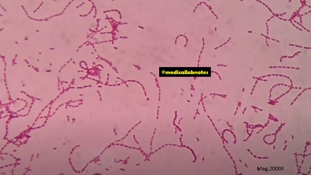 Streptobacillus gram stain footage