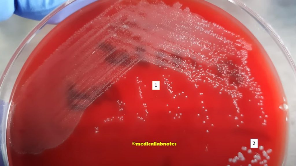 Streptococcus pinpoint colonies and Staphylococcus pin head colonies on blood agar Demonstration